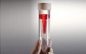 Фильтры центрифужные, 50 мл, 100 кД, белые, Jet Biofil