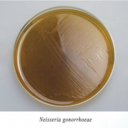 ГНК агар (гонококковая среда) ГНК агар (гонококковая среда)